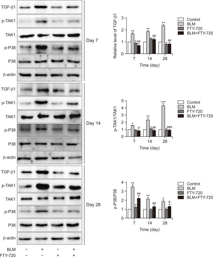 https://cdn.ncbi.nlm.nih.gov/pmc/blobs/dafe/10315338/7e9208599924/bt-31-4-434-f4.jpg
