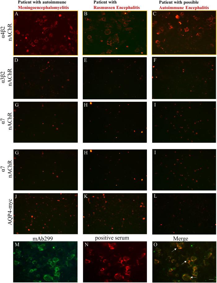 https://cdn.ncbi.nlm.nih.gov/pmc/blobs/db00/11165060/3cd4e86a9f65/fimmu-15-1388998-g002.jpg