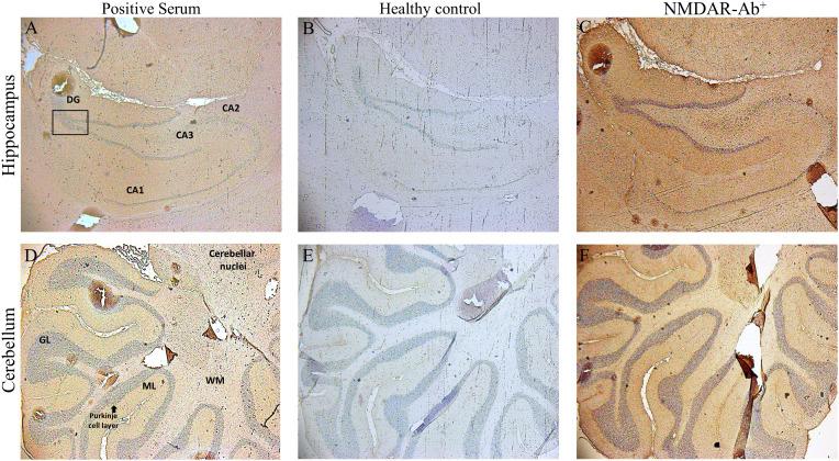 https://cdn.ncbi.nlm.nih.gov/pmc/blobs/db00/11165060/b600aba5c1ae/fimmu-15-1388998-g003.jpg