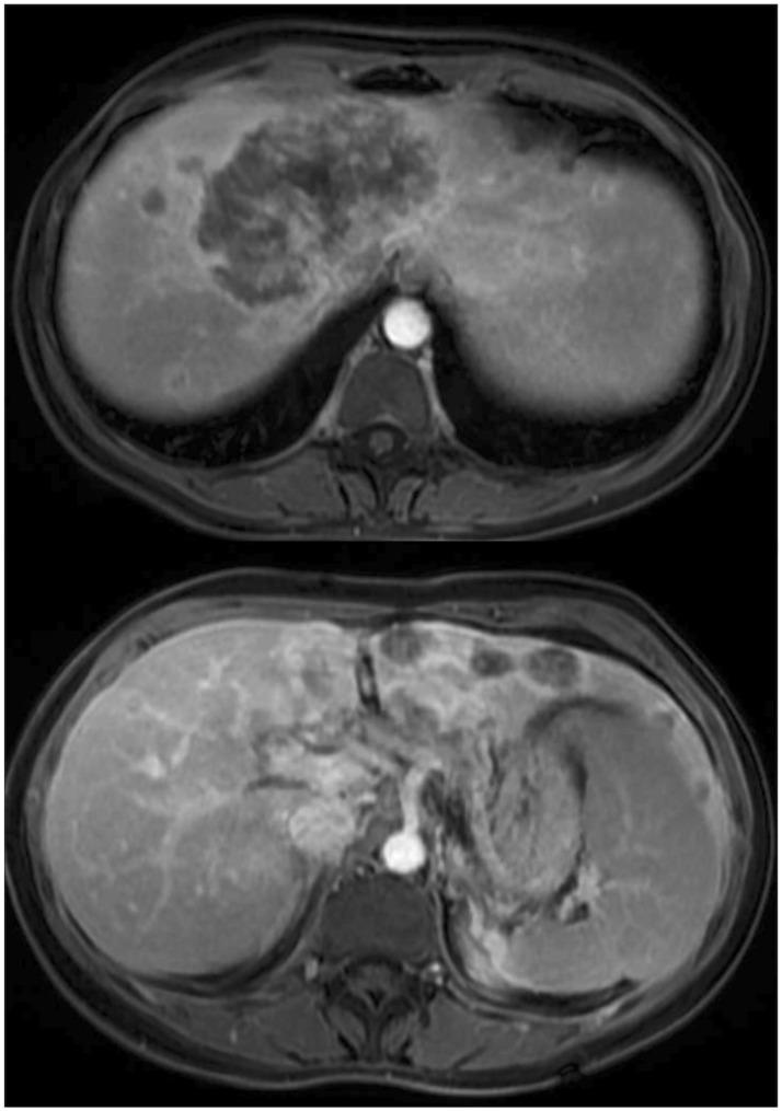 https://cdn.ncbi.nlm.nih.gov/pmc/blobs/db02/11148208/cfdd52f063fa/fonc-14-1404683-g001.jpg