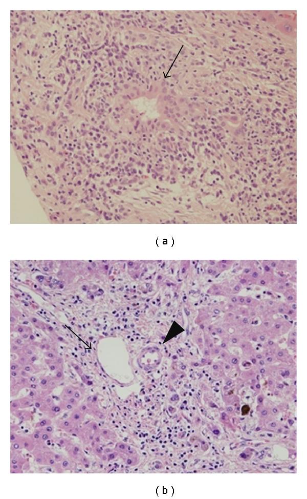 https://cdn.ncbi.nlm.nih.gov/pmc/blobs/db04/3168927/ba805eeea200/IJHEP2012-793569.002.jpg
