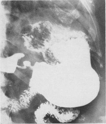 https://cdn.ncbi.nlm.nih.gov/pmc/blobs/db13/1617533/a671f0da6b3c/annsurg01477-0165-a.jpg