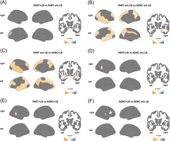 https://cdn.ncbi.nlm.nih.gov/pmc/blobs/db14/11772724/82d243402d63/ALZ-21-e14191-g003.jpg