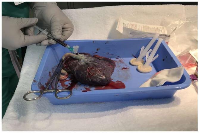 https://cdn.ncbi.nlm.nih.gov/pmc/blobs/db15/8119626/70fb60793855/fped-09-661321-g0001.jpg