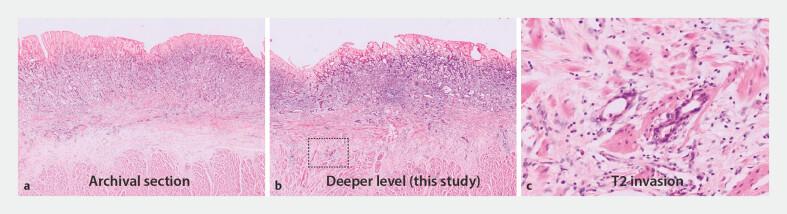 https://cdn.ncbi.nlm.nih.gov/pmc/blobs/db16/11855241/31126f754448/10-1055-a-2509-7208_25117598.jpg