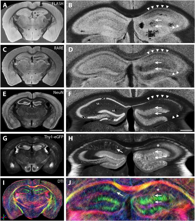 https://cdn.ncbi.nlm.nih.gov/pmc/blobs/db17/7284165/5f569cf2fb11/fnins-14-00543-g009.jpg