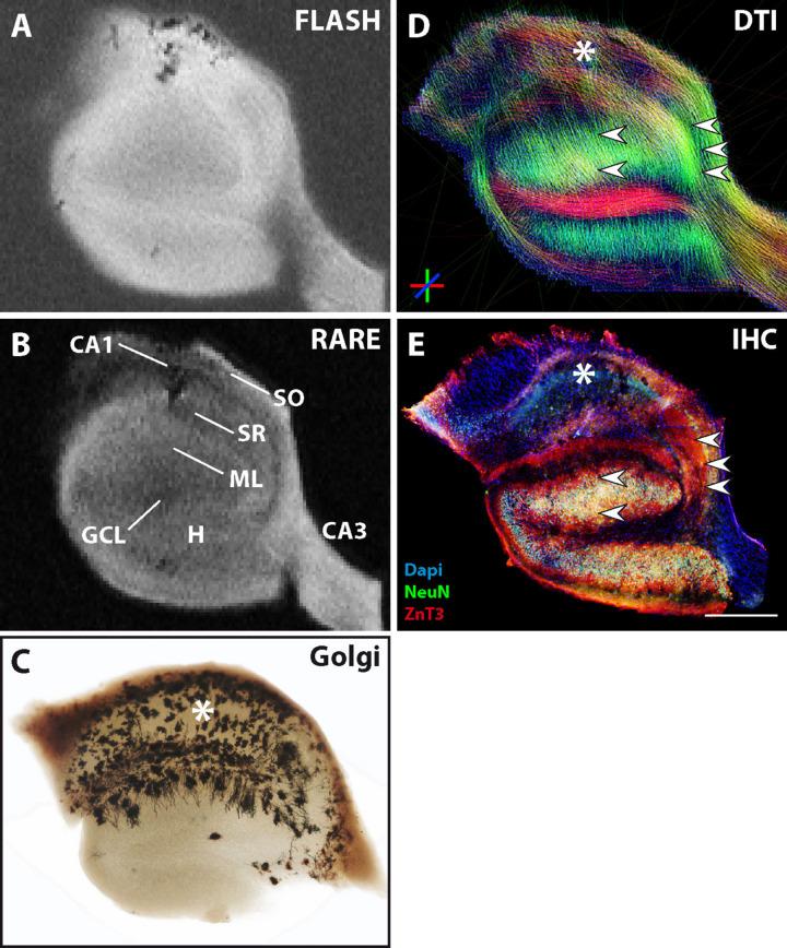 https://cdn.ncbi.nlm.nih.gov/pmc/blobs/db17/7284165/a654300317c5/fnins-14-00543-g003.jpg