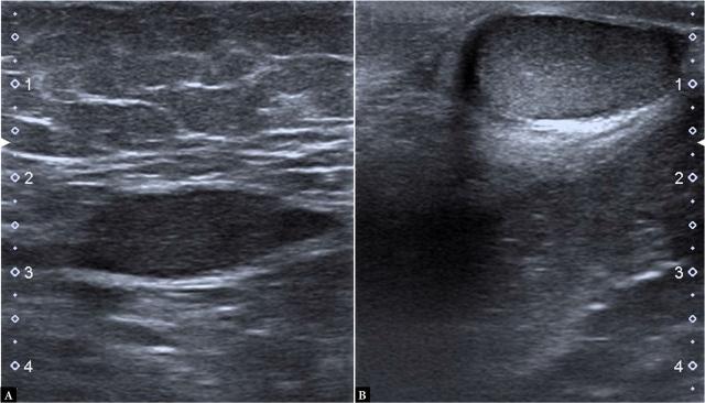 https://cdn.ncbi.nlm.nih.gov/pmc/blobs/db22/10850941/22ad28d5c4e2/j_jou.2024.0004_fig_001.jpg