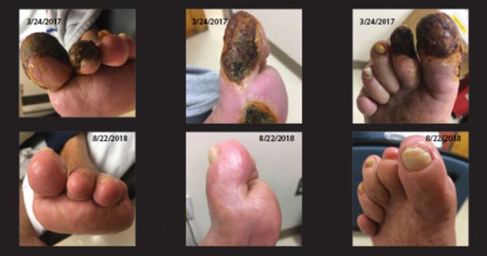 https://cdn.ncbi.nlm.nih.gov/pmc/blobs/db26/9075296/30e0afbceabd/JAH3-11-e024648-g001.jpg