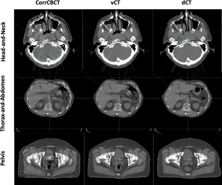 https://cdn.ncbi.nlm.nih.gov/pmc/blobs/db2a/11407964/34b2cf916ef2/gr2.jpg