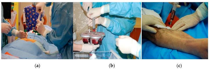 https://cdn.ncbi.nlm.nih.gov/pmc/blobs/db30/7731417/d5f18533fafc/ijms-21-08999-g002.jpg