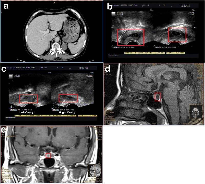 https://cdn.ncbi.nlm.nih.gov/pmc/blobs/db30/9938537/ed9e549e2a76/j_biol-2022-0548-fig002.jpg