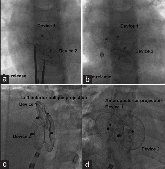 https://cdn.ncbi.nlm.nih.gov/pmc/blobs/db33/9564409/9eb94f343cff/APC-15-128-g004.jpg