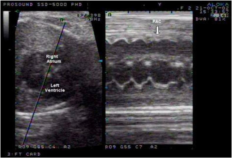 https://cdn.ncbi.nlm.nih.gov/pmc/blobs/db35/6531664/67eb70500164/gr1.jpg