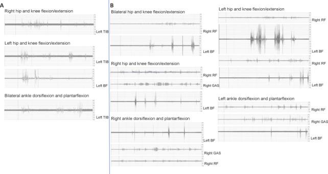 https://cdn.ncbi.nlm.nih.gov/pmc/blobs/db36/11759030/2f6a007ed994/NRR-20-2337-g006.jpg