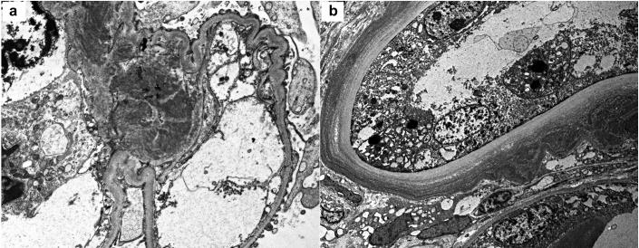 https://cdn.ncbi.nlm.nih.gov/pmc/blobs/db3a/6308384/5bba29396468/gr3.jpg