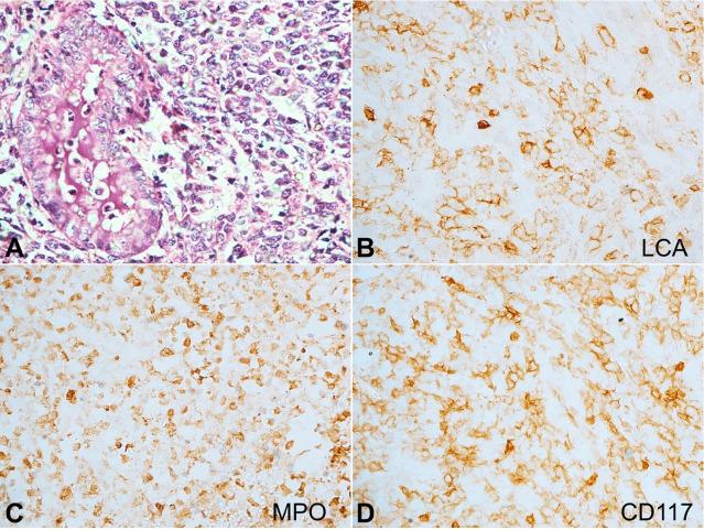 https://cdn.ncbi.nlm.nih.gov/pmc/blobs/db3b/8597781/66d582ae9271/autopsy-11-e2021339-g08.jpg