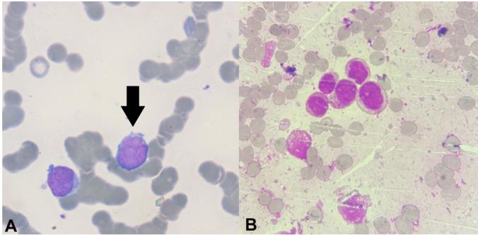 https://cdn.ncbi.nlm.nih.gov/pmc/blobs/db3b/8597781/aeefd87f208c/autopsy-11-e2021339-g01.jpg