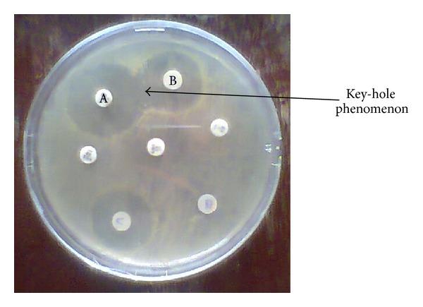 https://cdn.ncbi.nlm.nih.gov/pmc/blobs/db3f/3982411/e2ae5369d19f/IPID2014-819896.001.jpg