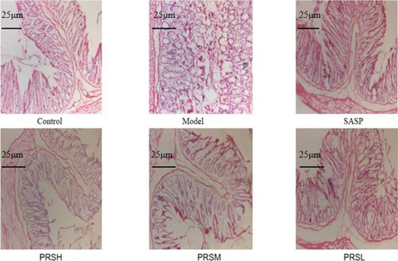 https://cdn.ncbi.nlm.nih.gov/pmc/blobs/db40/8602866/09514097a0cd/fcimb-11-728929-g002.jpg