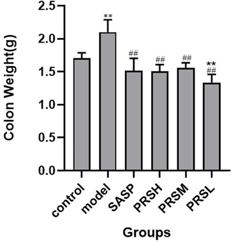 https://cdn.ncbi.nlm.nih.gov/pmc/blobs/db40/8602866/68eea9f64d2f/fcimb-11-728929-g004.jpg