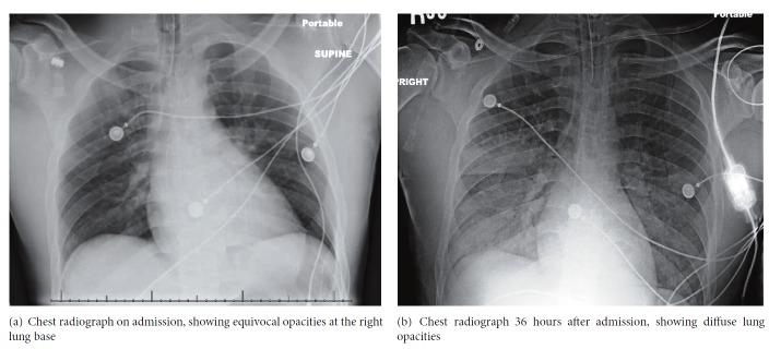 https://cdn.ncbi.nlm.nih.gov/pmc/blobs/db42/6545788/08e11586988a/CRIPU2019-8137648.001.jpg