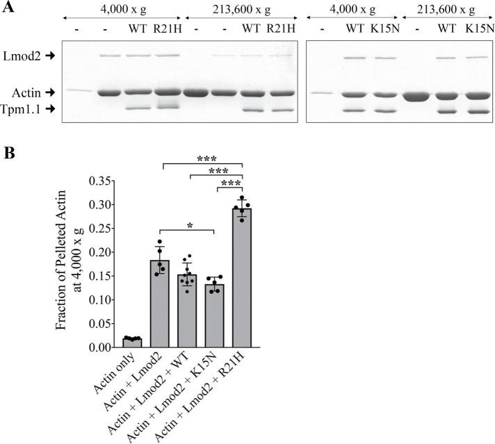https://cdn.ncbi.nlm.nih.gov/pmc/blobs/db4e/6589558/d73bc6eedea0/mbc-30-268-g008.jpg