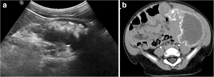 https://cdn.ncbi.nlm.nih.gov/pmc/blobs/db4e/6616606/32947f0504c5/13244_2019_743_Fig5_HTML.jpg