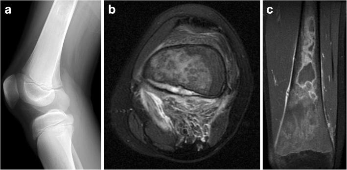 https://cdn.ncbi.nlm.nih.gov/pmc/blobs/db4e/6616606/7920904d0401/13244_2019_743_Fig10_HTML.jpg