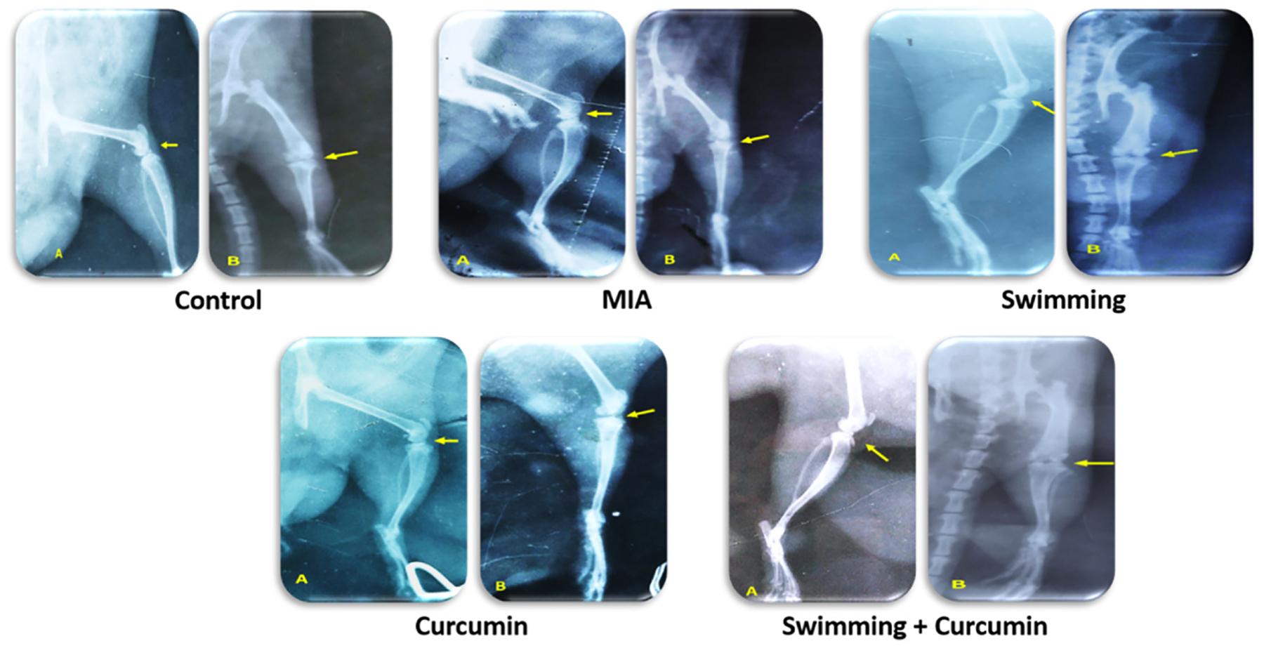 https://cdn.ncbi.nlm.nih.gov/pmc/blobs/db51/10538387/1ac479534905/nihms-1931054-f0009.jpg