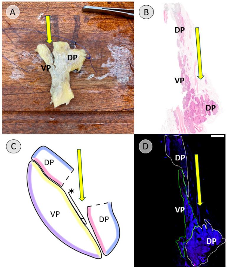 https://cdn.ncbi.nlm.nih.gov/pmc/blobs/db52/12189400/21e7d55c6896/biomedicines-13-01318-g010.jpg