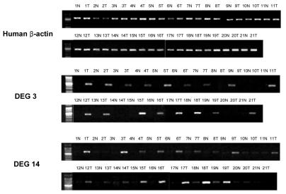 https://cdn.ncbi.nlm.nih.gov/pmc/blobs/db55/2649849/a4f1378f2832/ymj-50-60-g005.jpg
