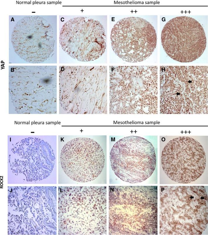 https://cdn.ncbi.nlm.nih.gov/pmc/blobs/db57/5661117/ab4d8f4b13bc/JCMM-21-2663-g006.jpg