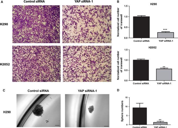 https://cdn.ncbi.nlm.nih.gov/pmc/blobs/db57/5661117/d5131c5c19be/JCMM-21-2663-g004.jpg