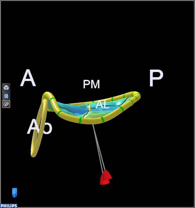 https://cdn.ncbi.nlm.nih.gov/pmc/blobs/db5d/4676476/663241c8c14b/echo-02-R63-g002.jpg