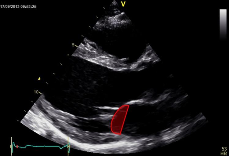 https://cdn.ncbi.nlm.nih.gov/pmc/blobs/db5d/4676476/988d6927f442/echo-02-R63-g012.jpg