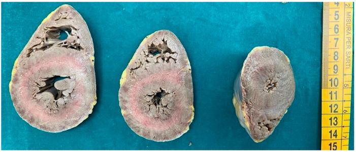 https://cdn.ncbi.nlm.nih.gov/pmc/blobs/db69/12026069/b6c626617d0c/diagnostics-15-00999-g001.jpg