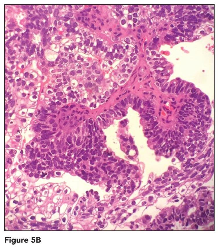 https://cdn.ncbi.nlm.nih.gov/pmc/blobs/db6b/6150586/7199b66578cb/asm-37-4-265-g005b.jpg