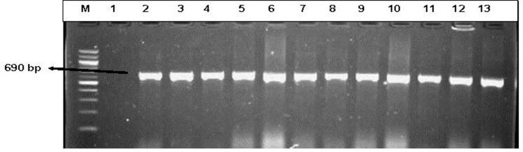 https://cdn.ncbi.nlm.nih.gov/pmc/blobs/db72/7764871/8fe816531026/IDR-13-4615-g0004.jpg