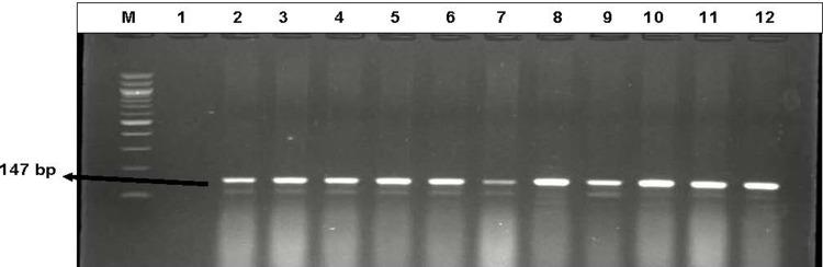 https://cdn.ncbi.nlm.nih.gov/pmc/blobs/db72/7764871/eb1889044b44/IDR-13-4615-g0001.jpg