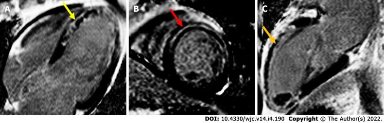 https://cdn.ncbi.nlm.nih.gov/pmc/blobs/db73/9048277/674cb18c97ee/WJC-14-190-g003.jpg