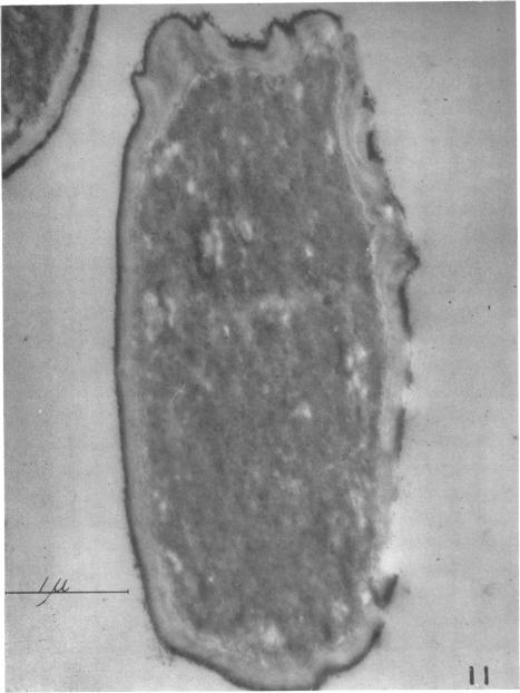 https://cdn.ncbi.nlm.nih.gov/pmc/blobs/db75/386243/01c282963dda/jbacter00602-0094-a.jpg