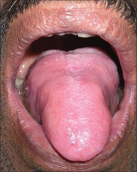 https://cdn.ncbi.nlm.nih.gov/pmc/blobs/db7c/5320878/cd719f440821/JLP-9-136-g006.jpg