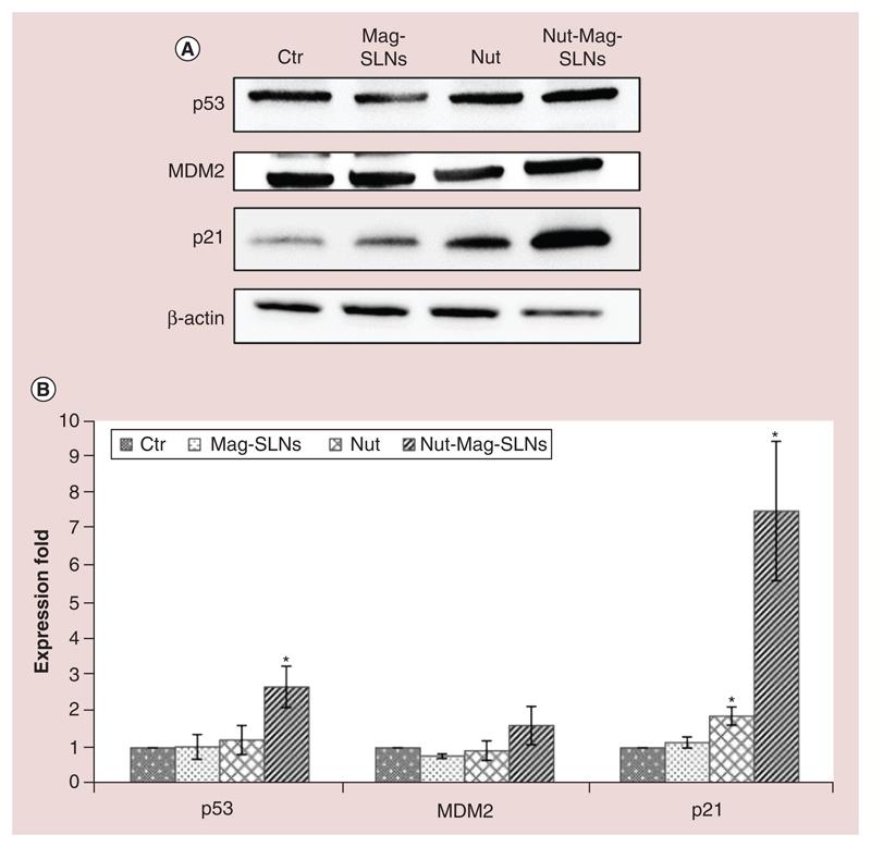https://cdn.ncbi.nlm.nih.gov/pmc/blobs/db8a/6701990/e8eee1a5be2b/EMS83995-f006.jpg
