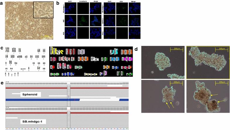 https://cdn.ncbi.nlm.nih.gov/pmc/blobs/db8c/5412046/cbd09a4870ba/12967_2017_1197_Fig2_HTML.jpg