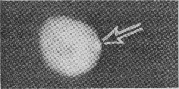 https://cdn.ncbi.nlm.nih.gov/pmc/blobs/db8d/1819622/0132f4ddcde1/brmedj02157-0086-a.jpg