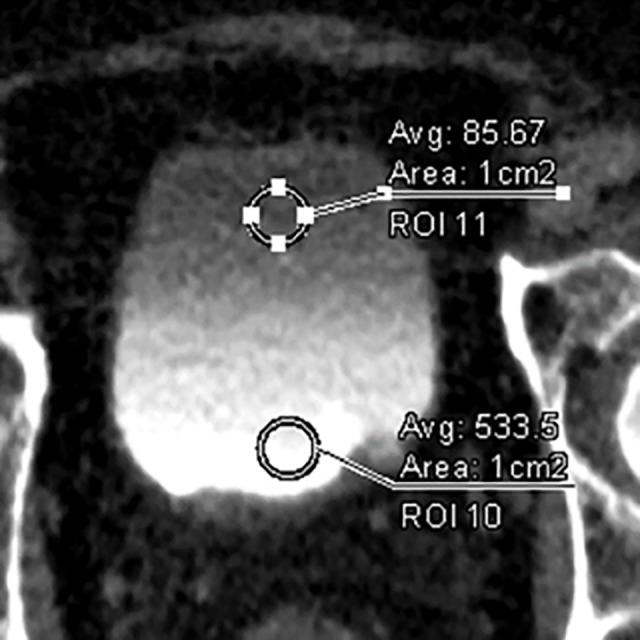 https://cdn.ncbi.nlm.nih.gov/pmc/blobs/db94/5383231/02753b2c0fe5/pone.0174800.g002.jpg