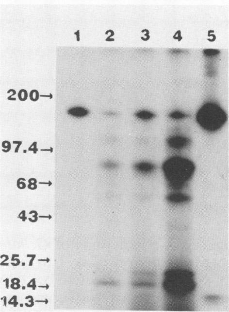 https://cdn.ncbi.nlm.nih.gov/pmc/blobs/db95/259415/49ff3b42998f/iai00078-0023-b.jpg