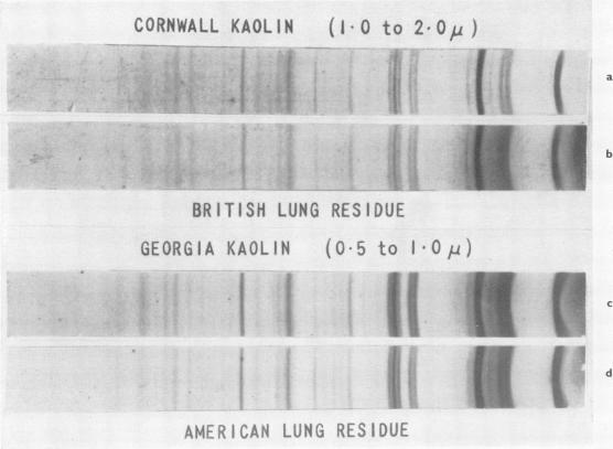 https://cdn.ncbi.nlm.nih.gov/pmc/blobs/db9b/1037711/3d842fd54513/brjindmed00224-0028-a.jpg