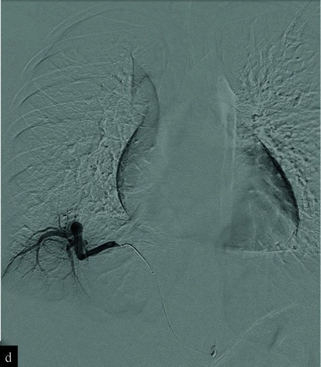https://cdn.ncbi.nlm.nih.gov/pmc/blobs/db9d/9479504/e19a83664188/JCIS-12-36-g004.jpg